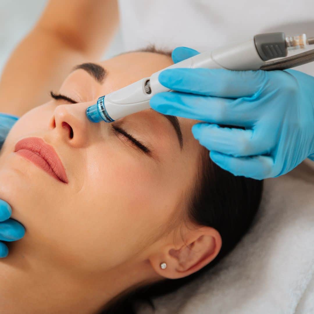 HydraFacial for Brides: Achieve Glowing Skin Before Your Big Day